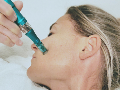 <h2>Vampirlifting</h2>
      Die Anwendung mit körpereigenem plättchenreichem Plasma sorgt für eine frischere und straffere Haut.
Einsatz findet die Behandlung bei Falten, Narben und Pigmentstörungen. Es regt die Kollagen- und Elastinproduktion an.
Das Plasma wird mit einem Microneedling Pen eingearbeitet, daher kommt es nur zu einer leichten Rötung des behandelten Areals und zu keiner Ausfallzeit.
Die Anzahl der Behandlungen ist individuell. 
Am sinnvollsten sind 3-4 Sitzungen, alle 4 Wochen.